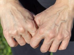 cara tangan berurat