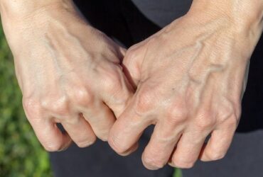 cara tangan berurat